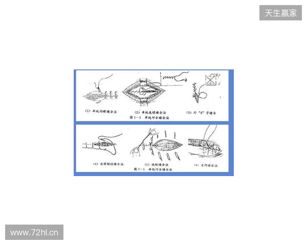 广州豹官方：杨浩眉弓伤口缝合30余针，预计5-7天后拆线